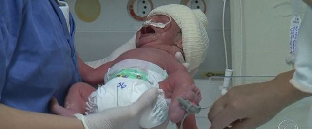  Gêmeas nascem com três dias de diferença e surpreendem os pais e os médicos.