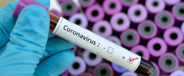 Bahia confirma primeira morte por coronavírus no estado