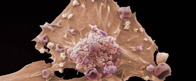 Cientistas planejam criar câncer para pesquisar sinais precoces da doença