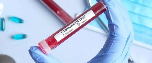 Hospital Albert Einstein desenvolve teste para o coronavírus que une alta precisão e detecção em larga escala